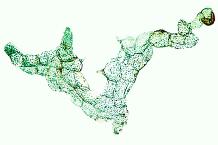 Mikropräparat - Farnprothallium (Vorkeim), junges fadenförmiges Stadium, total