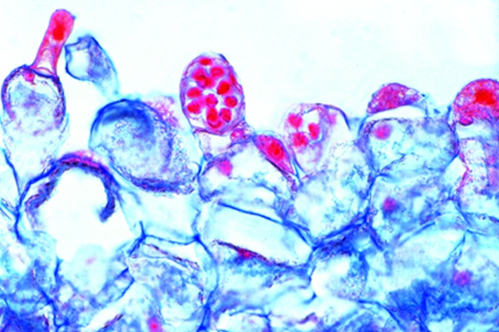 Mikropräparat - Farnprothallium, Längsschnitt mit Antheridien