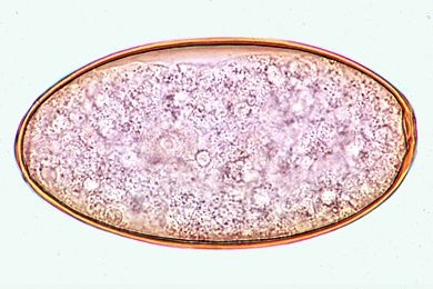 Mikropräparat - Fasciola hepatica, Eier aus dem Gallensediment vom Rind