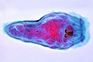 Mikropräparat - Fasciola hepatica, Miracidien (Wimperlarven)