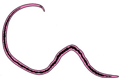 Mikropräparat - Schistosoma mansoni, Weibchen total
