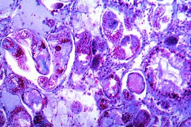 Mikropräparat - Schistosoma mansoni, Schnitt durch eine infizierte Schneckenleber mit Furcocercarien