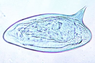 Mikropräparat - Schistosoma mansoni, Eier im Stuhl