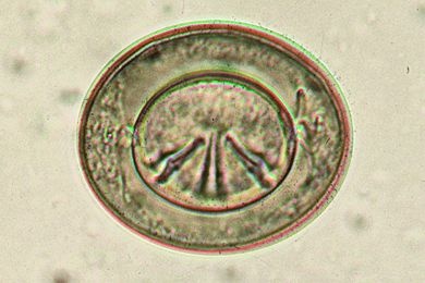 Mikropräparat - Hymenolepis nana, Eier im Stuhl
