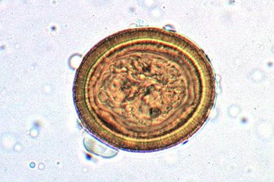 Mikropräparat - Echinococcus granulosus, Eier im Hundekot
