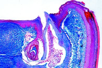 Mikropräparat - Lacerta, Querschnitt durch den Kiefer. Zahnersatz