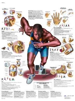 Anatomische Lehrtafel, Sportverletzungen