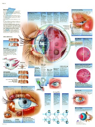 Anatomische Lehrtafel, Erkrankungen des Auges