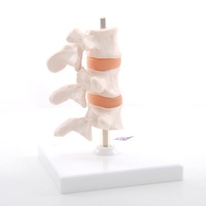 Osteoporose-Luxusmodell (3 Wirbel)